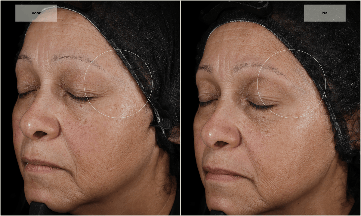 Led masker, Dermatologisch getest