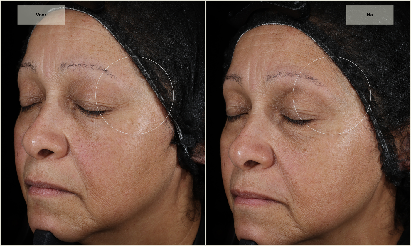 Nova Series Dermatologisch getest - De gevoelige huid