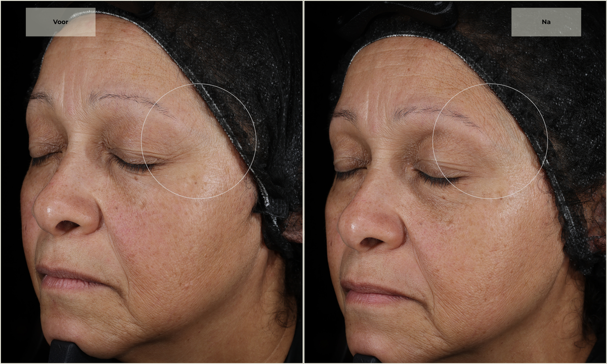Nova Series Dermatologisch getest - De gevoelige huid