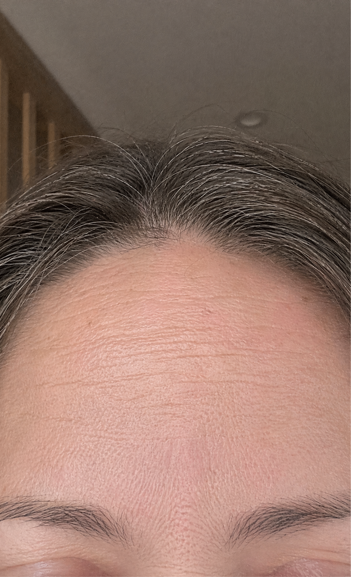 Before