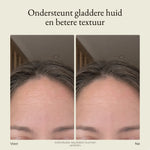 maxi meilleur nova series full set wit transformatie